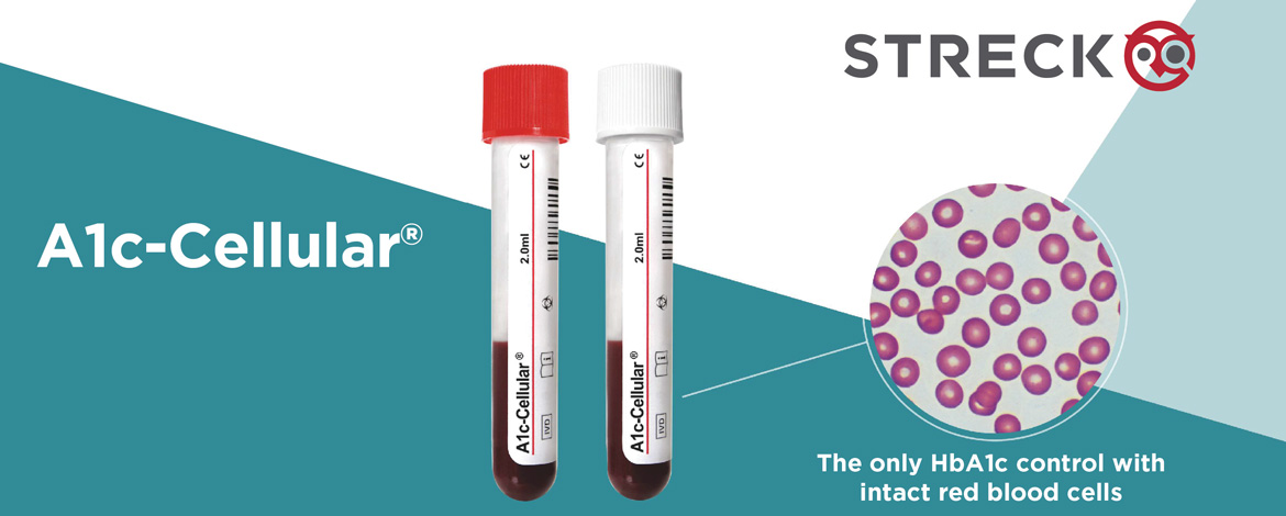 streck urinalysis controls